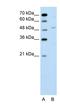 Zinc Finger Protein 19 antibody, NBP1-53031, Novus Biologicals, Western Blot image 