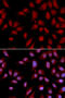DLG Associated Protein 5 antibody, 18-568, ProSci, Immunofluorescence image 