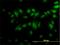 CDC Like Kinase 3 antibody, H00001198-M05, Novus Biologicals, Immunofluorescence image 