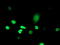 ATR-interacting protein antibody, TA504642, Origene, Immunofluorescence image 