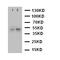 C-X-C Motif Chemokine Receptor 5 antibody, LS-C313147, Lifespan Biosciences, Western Blot image 