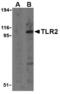 Toll Like Receptor 2 antibody, TA306125, Origene, Western Blot image 