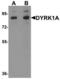 Dual Specificity Tyrosine Phosphorylation Regulated Kinase 1A antibody, LS-C144354, Lifespan Biosciences, Western Blot image 