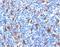 Fascin Actin-Bundling Protein 1 antibody, orb385897, Biorbyt, Immunohistochemistry paraffin image 