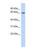 SSX Family Member 7 antibody, NBP1-79468, Novus Biologicals, Western Blot image 