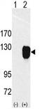 Receptor Tyrosine Kinase Like Orphan Receptor 1 antibody, AP14412PU-N, Origene, Western Blot image 