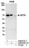 SET Domain Containing 3, Actin Histidine Methyltransferase antibody, A304-072A, Bethyl Labs, Immunoprecipitation image 