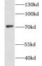 Glutathione S-transferase C-terminal domain-containing protein antibody, FNab03690, FineTest, Western Blot image 