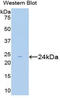 SMAD2 antibody, LS-C295418, Lifespan Biosciences, Western Blot image 