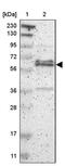 Zinc Finger Protein 135 antibody, PA5-52368, Invitrogen Antibodies, Western Blot image 