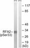 Replication Protein A2 antibody, P02067, Boster Biological Technology, Western Blot image 
