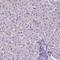 ATRX Chromatin Remodeler antibody, AMAb90784, Atlas Antibodies, Immunohistochemistry frozen image 