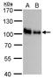 Hyaluronate receptor antibody, TA308864, Origene, Western Blot image 