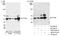 Phosphatidylinositol-3,4,5-trisphosphate 3-phosphatase and dual-specificity protein phosphatase PTEN antibody, A300-701A, Bethyl Labs, Western Blot image 