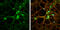Discs Large MAGUK Scaffold Protein 2 antibody, GTX133244, GeneTex, Immunofluorescence image 