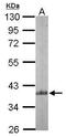 Actin Related Protein 2/3 Complex Subunit 1B antibody, GTX104742, GeneTex, Western Blot image 