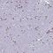 Late Cornified Envelope 6A antibody, NBP1-94116, Novus Biologicals, Immunohistochemistry frozen image 