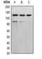 Progesterone Receptor antibody, orb338954, Biorbyt, Western Blot image 