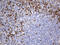 Optineurin antibody, LS-C796267, Lifespan Biosciences, Immunohistochemistry paraffin image 