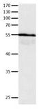 Haptoglobin antibody, orb107397, Biorbyt, Western Blot image 