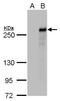 Methylcytosine dioxygenase TET2 antibody, MA5-18299, Invitrogen Antibodies, Western Blot image 