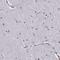 Alpha-N-acetylgalactosaminidase antibody, HPA000649, Atlas Antibodies, Immunohistochemistry paraffin image 