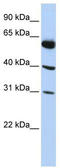 LysM Domain Containing 4 antibody, TA338855, Origene, Western Blot image 
