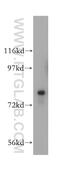 Hydroxysteroid 17-Beta Dehydrogenase 4 antibody, 15116-1-AP, Proteintech Group, Western Blot image 