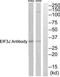 Eukaryotic translation initiation factor 3 subunit J antibody, TA314787, Origene, Western Blot image 