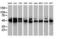 Protein kinase C and casein kinase substrate in neurons protein 3 antibody, LS-C172531, Lifespan Biosciences, Western Blot image 