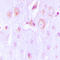 Tyrosine Hydroxylase antibody, LS-C354112, Lifespan Biosciences, Immunohistochemistry paraffin image 
