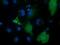 Peroxisomal trans-2-enoyl-CoA reductase antibody, GTX83914, GeneTex, Immunofluorescence image 