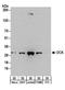 Deoxycytidine kinase antibody, A304-266A, Bethyl Labs, Western Blot image 