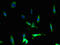 C-C Motif Chemokine Receptor 1 antibody, orb23015, Biorbyt, Immunocytochemistry image 