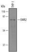 Adhesion G Protein-Coupled Receptor E2 antibody, AF4894, R&D Systems, Western Blot image 
