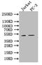 Natural Killer Cell Cytotoxicity Receptor 3 Ligand 1 antibody, CSB-PA737873LA01HU, Cusabio, Western Blot image 