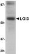 Leucine-rich repeat LGI family member 3 antibody, orb74950, Biorbyt, Western Blot image 
