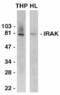 Interleukin 1 Receptor Associated Kinase 1 antibody, AHP445, Bio-Rad (formerly AbD Serotec) , Western Blot image 