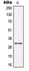 Gap Junction Protein Beta 1 antibody, LS-C352243, Lifespan Biosciences, Western Blot image 