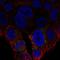 Uncoupling Protein 2 antibody, HPA075202, Atlas Antibodies, Immunocytochemistry image 