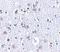 BR Serine/Threonine Kinase 1 antibody, A05997-1, Boster Biological Technology, Immunohistochemistry paraffin image 
