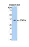 Trefoil Factor 3 antibody, LS-C300308, Lifespan Biosciences, Western Blot image 