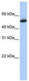Cytochrome P450 Family 4 Subfamily B Member 1 antibody, TA346227, Origene, Western Blot image 