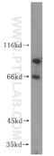 VAC14 Component Of PIKFYVE Complex antibody, 15771-1-AP, Proteintech Group, Western Blot image 