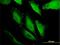 Ring Finger Protein 217 antibody, H00154214-M01, Novus Biologicals, Immunocytochemistry image 
