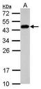 Scm Polycomb Group Protein Like 4 antibody, PA5-31976, Invitrogen Antibodies, Western Blot image 