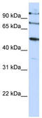 F-Box Protein 5 antibody, TA329826, Origene, Western Blot image 