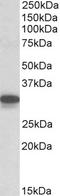 Cytochrome B5 Reductase 3 antibody, STJ72488, St John
