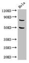 Kelch Repeat And BTB Domain Containing 6 antibody, CSB-PA774812LA01HU, Cusabio, Western Blot image 