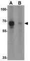 B-cell lymphoma 6 protein antibody, GTX31491, GeneTex, Western Blot image 
